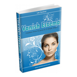 Vanish Eczema by Lee Gardner